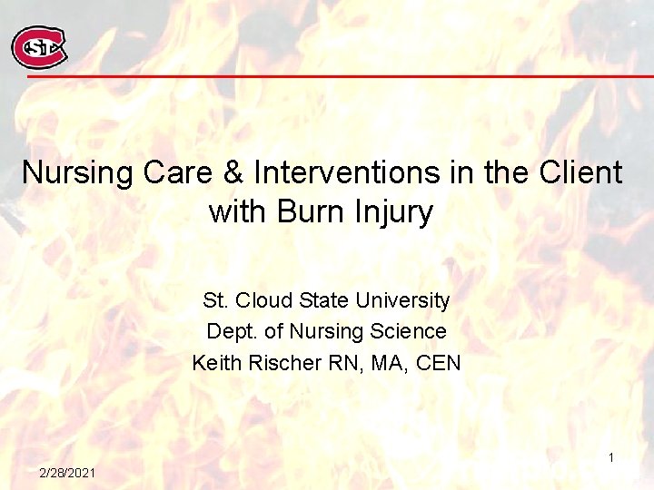 Nursing Care & Interventions in the Client with Burn Injury St. Cloud State University