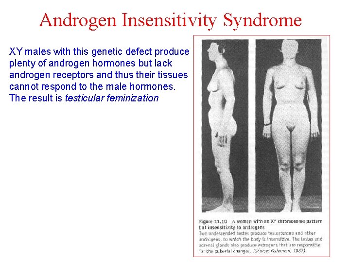 Androgen Insensitivity Syndrome XY males with this genetic defect produce plenty of androgen hormones