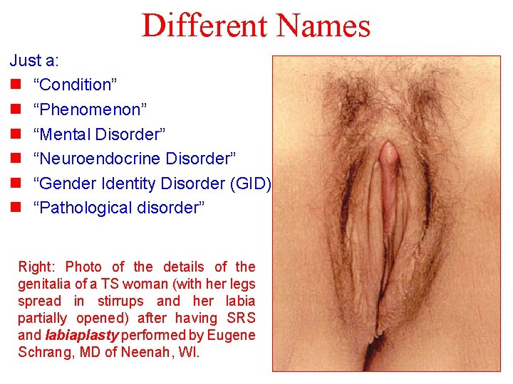 Different Names Just a: n “Condition” n “Phenomenon” n “Mental Disorder” n “Neuroendocrine Disorder”