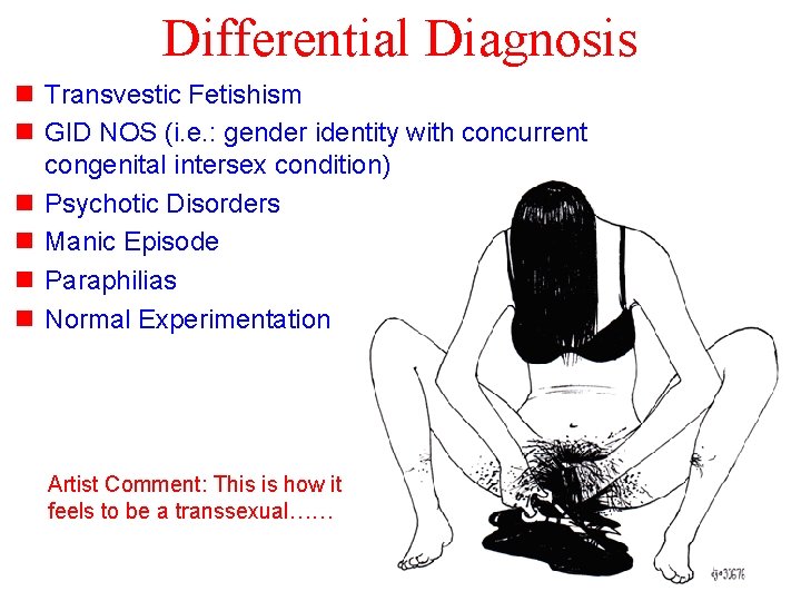 Differential Diagnosis n Transvestic Fetishism n GID NOS (i. e. : gender identity with