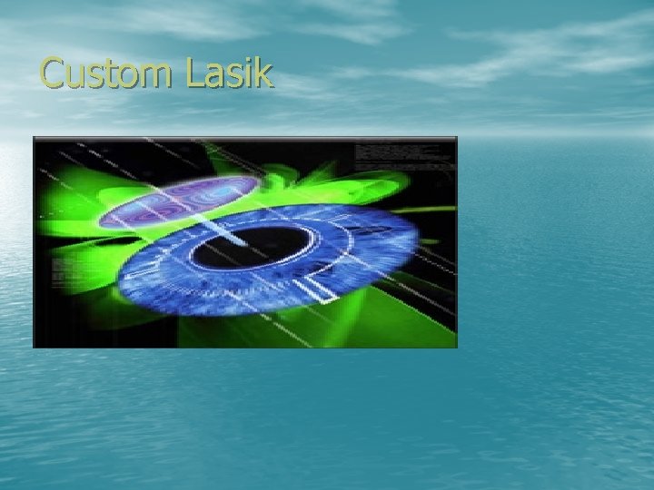 Custom Lasik 