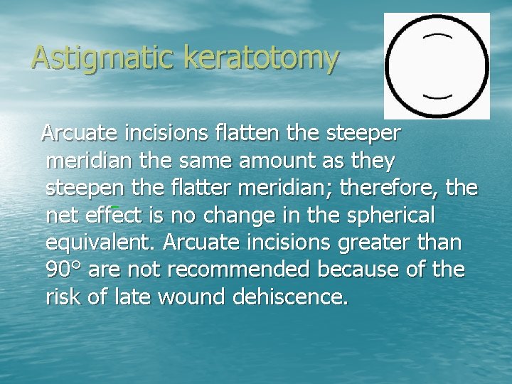 Astigmatic keratotomy Arcuate incisions flatten the steeper meridian the same amount as they steepen