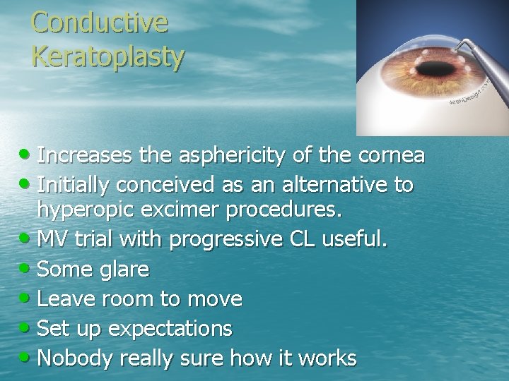 Conductive Keratoplasty • Increases the asphericity of the cornea • Initially conceived as an