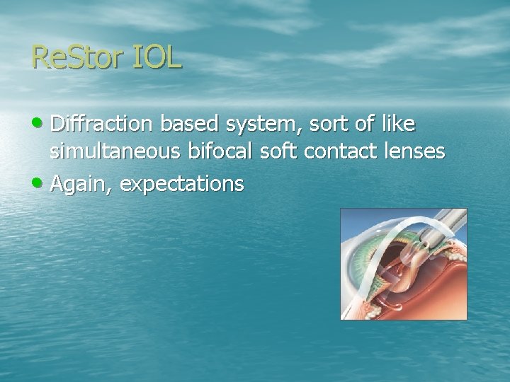 Re. Stor IOL • Diffraction based system, sort of like simultaneous bifocal soft contact