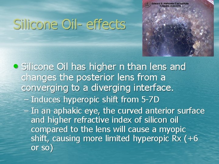 Silicone Oil- effects • Silicone Oil has higher n than lens and changes the