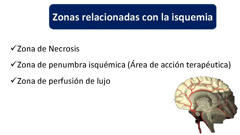 Zonas relacionadas con la isquemia üZona de Necrosis üZona de penumbra isquémica (Área de Zonas relacionadas con la isquemia üZona de Necrosis üZona de penumbra isquémica (Área de