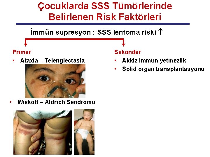 Çocuklarda SSS Tümörlerinde Belirlenen Risk Faktörleri İmmün supresyon : SSS lenfoma riski Primer •