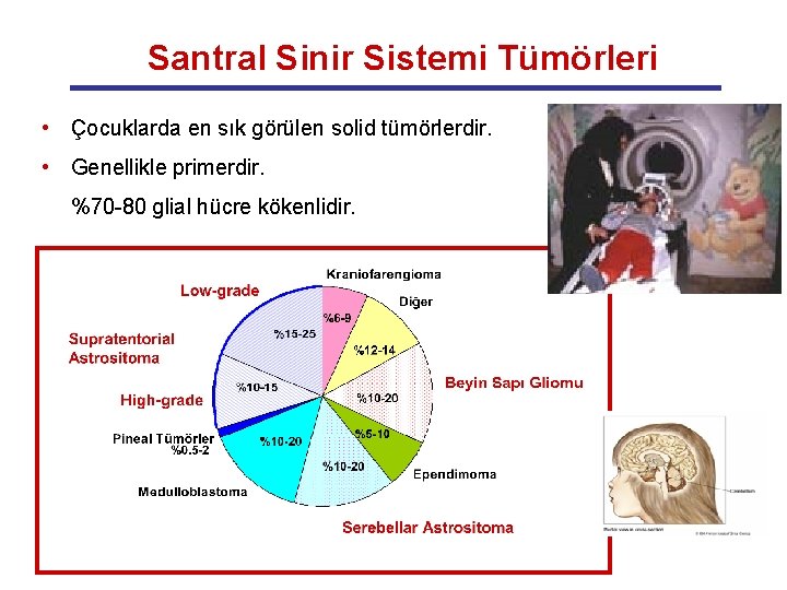 Santral Sinir Sistemi Tümörleri • Çocuklarda en sık görülen solid tümörlerdir. • Genellikle primerdir.