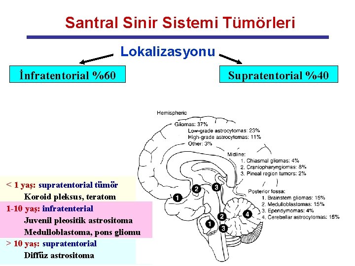 Santral Sinir Sistemi Tümörleri Lokalizasyonu İnfratentorial %60 < 1 yaş: supratentorial tümör Koroid pleksus,