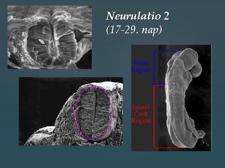 Neurulatio 2 (17 -29. nap) Neurulatio 2 