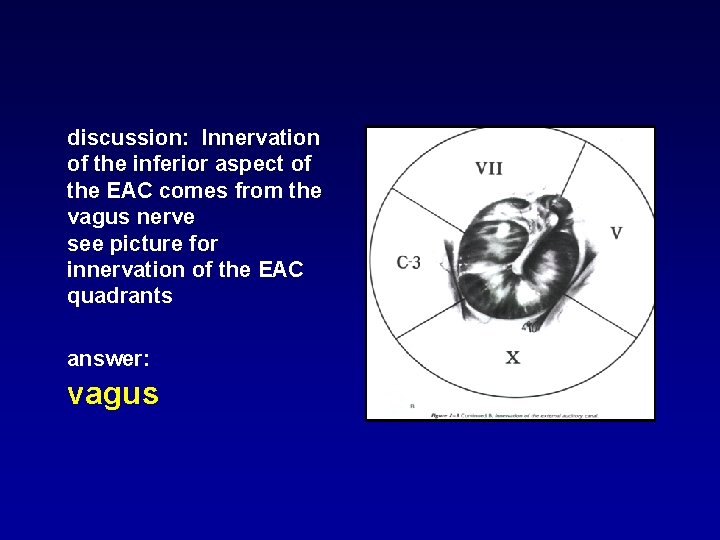 discussion: Innervation of the inferior aspect of the EAC comes from the vagus nerve discussion: Innervation of the inferior aspect of the EAC comes from the vagus nerve