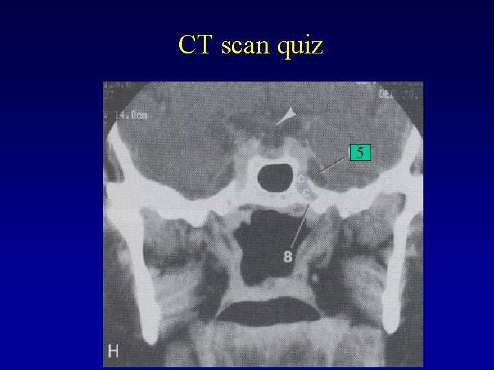 CT scan quiz 5 CT scan quiz 5