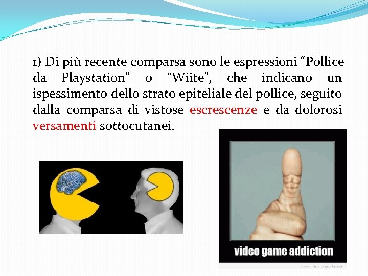 1) Di più recente comparsa sono le espressioni “Pollice da Playstation” o “Wiite”, che