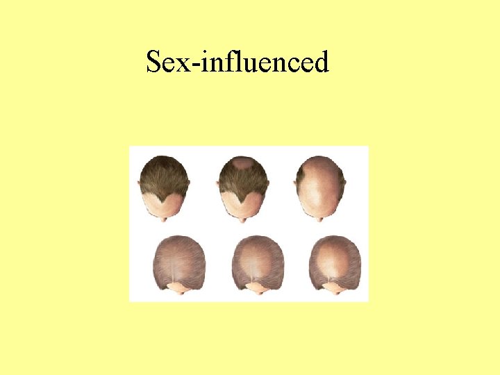 Sex-influenced 
