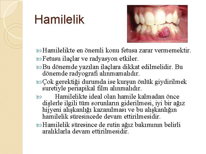 Hamilelik Hamilelikte en önemli konu fetusa zarar vermemektir. Fetusu ilaçlar ve radyasyon etkiler. Bu