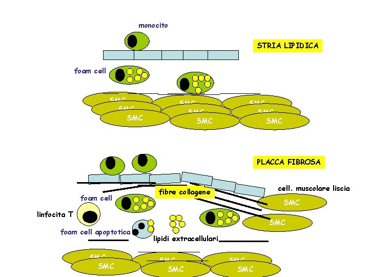 monocito STRIA LIPIDICA foam cell SMC SMC SMC PLACCA FIBROSA foam cell. muscolare liscia