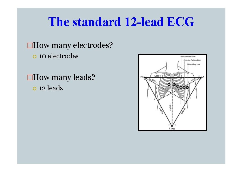 The standard 12 -lead ECG �How many electrodes? 10 electrodes �How many leads? 12