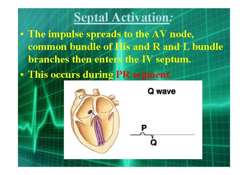 Septal Activation: • The impulse spreads to the AV node, common bundle of His