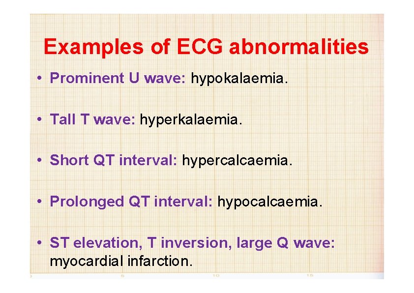 Examples of ECG abnormalities • Prominent U wave: hypokalaemia. • Tall T wave: hyperkalaemia.