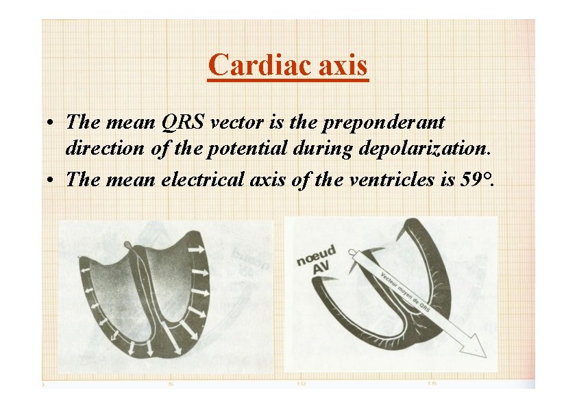 Cardiac axis • The mean QRS vector is the preponderant direction of the potential
