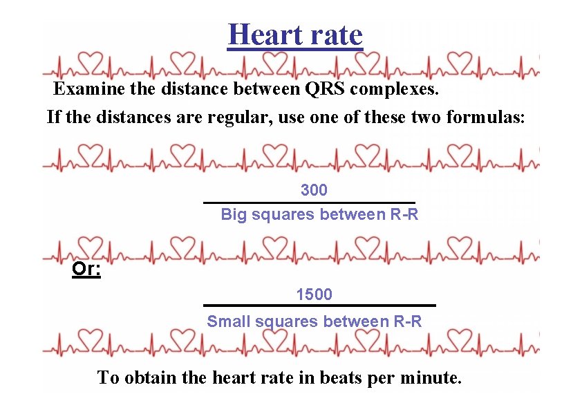 Heart rate Examine the distance between QRS complexes. If the distances are regular, use