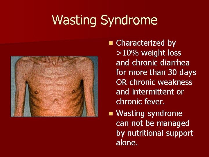 Wasting Syndrome Characterized by >10% weight loss and chronic diarrhea for more than 30