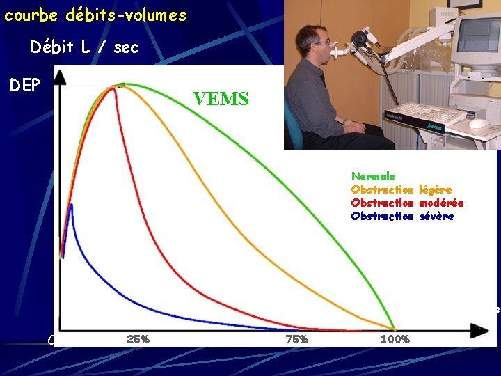 courbe débits-volumes Débit L / sec DEP VEMS Normale Obstruction légère Obstruction modérée Obstruction