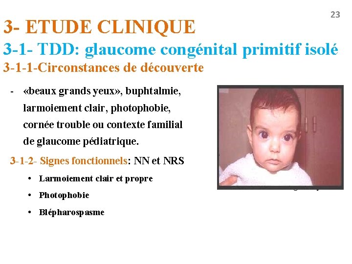 3 - ETUDE CLINIQUE 23 3 -1 - TDD: glaucome congénital primitif isolé 3