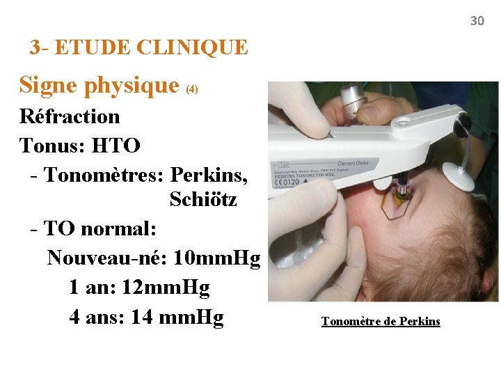 30 3 - ETUDE CLINIQUE Signe physique (4) Réfraction Tonus: HTO - Tonomètres: Perkins,