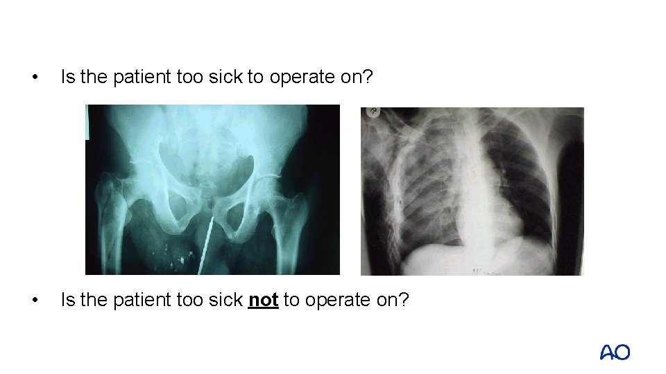 • Is the patient too sick to operate on? • Is the patient • Is the patient too sick to operate on? • Is the patient