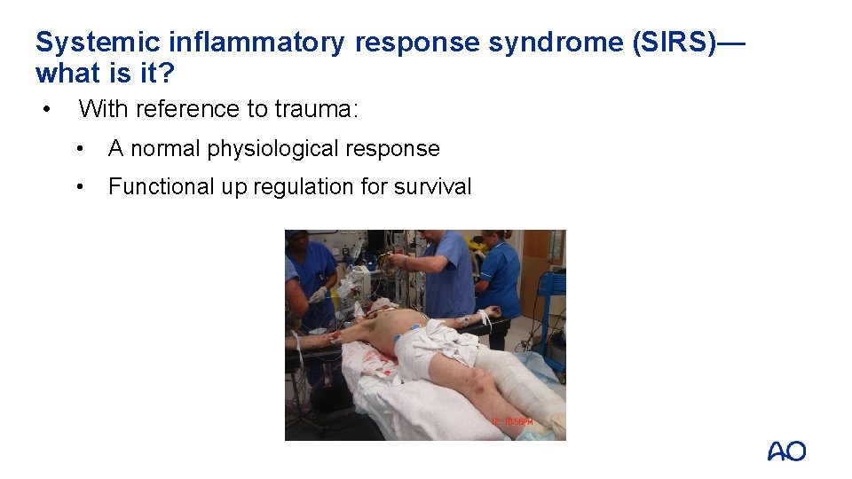 Systemic inflammatory response syndrome (SIRS)— what is it? • With reference to trauma: • Systemic inflammatory response syndrome (SIRS)— what is it? • With reference to trauma: •