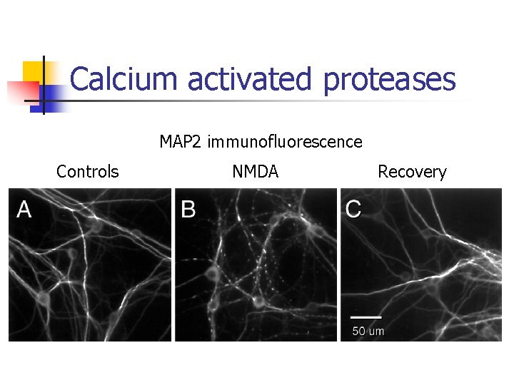 Calcium activated proteases MAP 2 immunofluorescence Controls NMDA Recovery 