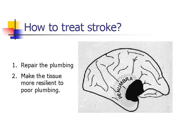 How to treat stroke? 1. Repair the plumbing 2. Make the tissue more resilient