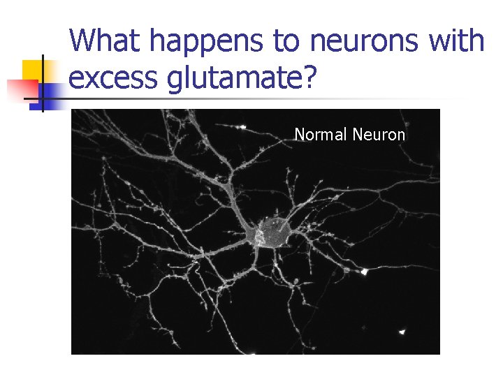 What happens to neurons with excess glutamate? Normal Neuron 