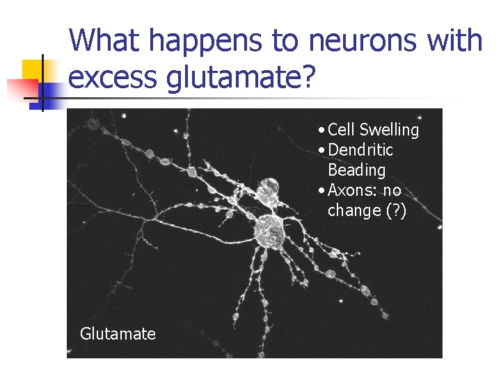 What happens to neurons with excess glutamate? • Cell Swelling • Dendritic Beading •