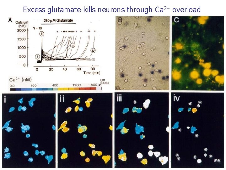 Excess glutamate kills neurons through Ca 2+ overload 