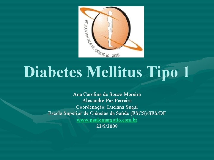 Diabetes Mellitus Tipo 1 Ana Carolina de Souza Moreira Alexandre Paz Ferreira Coordenação: Luciana