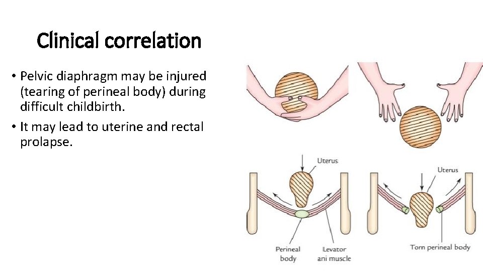 Clinical correlation • Pelvic diaphragm may be injured (tearing of perineal body) during difficult