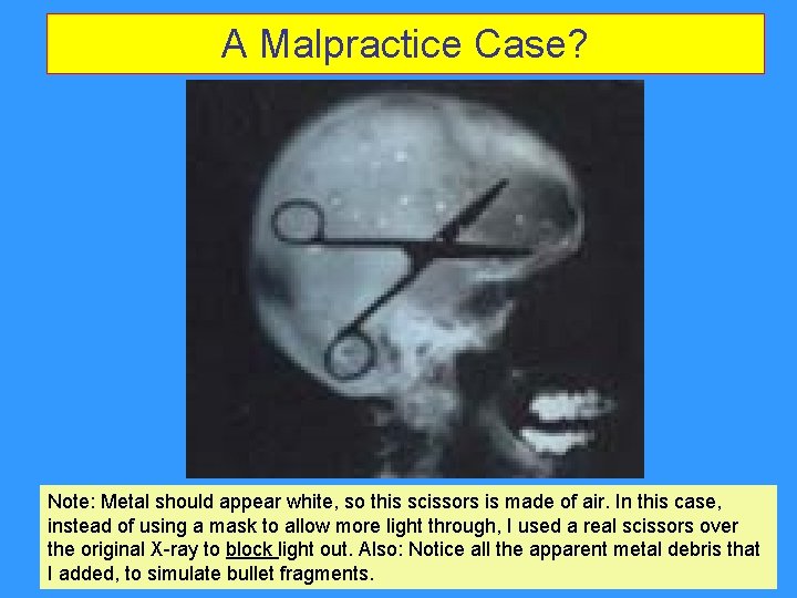 A Malpractice Case? Note: Metal should appear white, so this scissors is made of A Malpractice Case? Note: Metal should appear white, so this scissors is made of