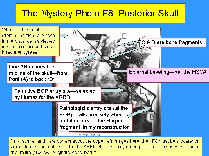 The Mystery Photo F 8: Posterior Skull *Nipple, chest wall, and fat (from Y-incision) The Mystery Photo F 8: Posterior Skull *Nipple, chest wall, and fat (from Y-incision)