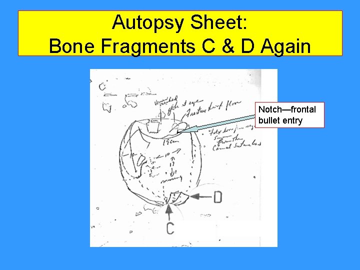 Autopsy Sheet: Bone Fragments C & D Again Notch—frontal bullet entry Autopsy Sheet: Bone Fragments C & D Again Notch—frontal bullet entry