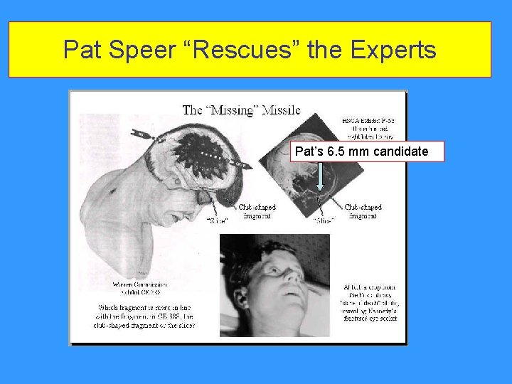 Pat Speer “Rescues” the Experts Pat’s 6. 5 mm candidate Pat Speer “Rescues” the Experts Pat’s 6. 5 mm candidate