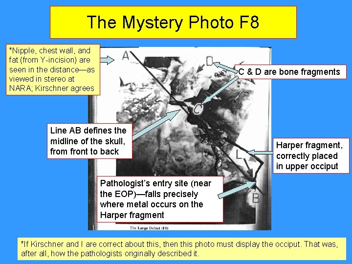 The Mystery Photo F 8 *Nipple, chest wall, and fat (from Y-incision) are seen The Mystery Photo F 8 *Nipple, chest wall, and fat (from Y-incision) are seen