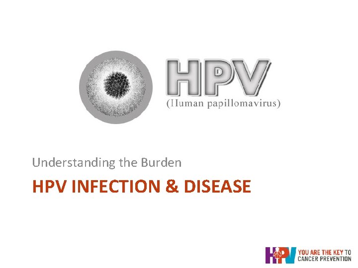 Understanding the Burden HPV INFECTION & DISEASE Understanding the Burden HPV INFECTION & DISEASE