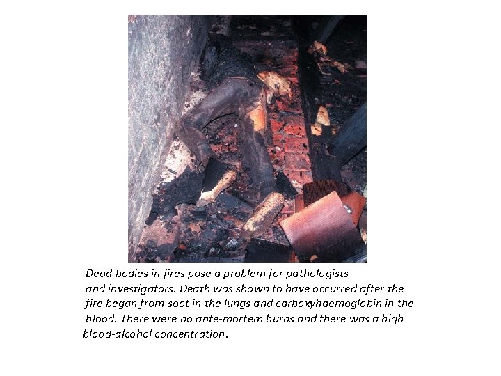 Dead bodies in fires pose a problem for pathologists and investigators. Death was shown
