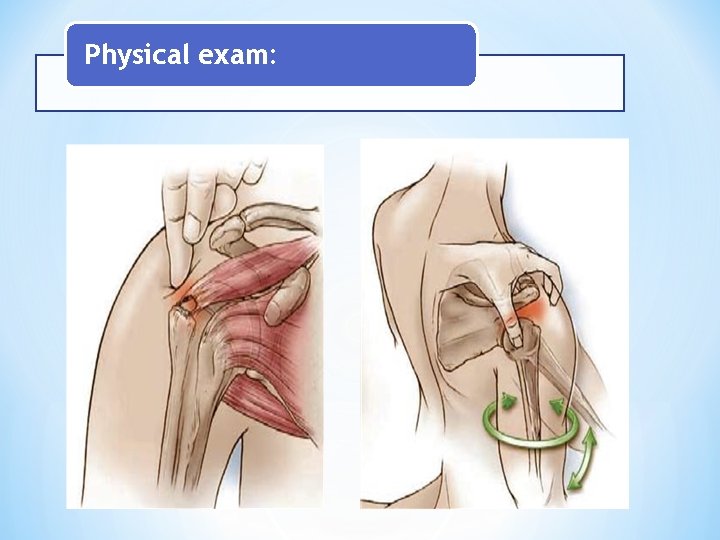 Physical exam: Physical exam: