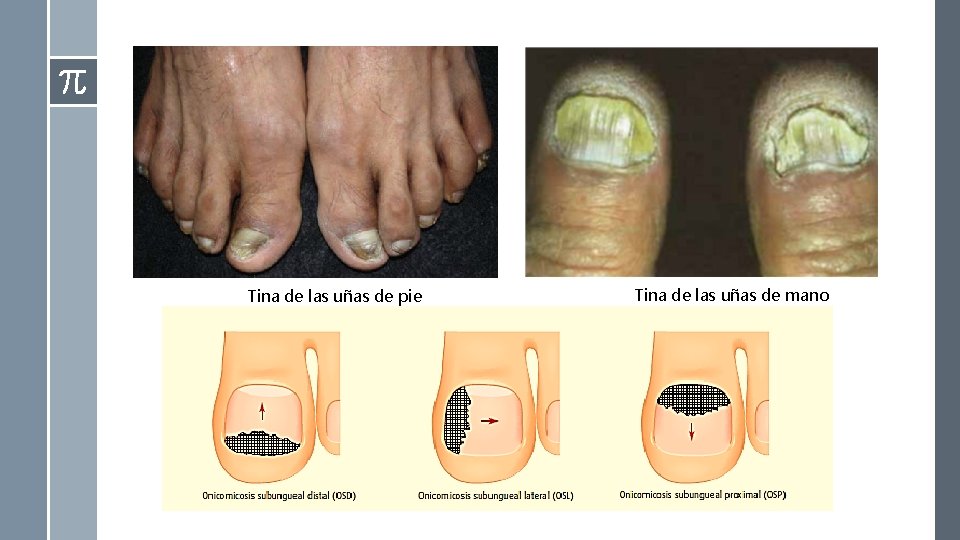 Tina de las uñas de pie Tina de las uñas de mano Tina de las uñas de pie Tina de las uñas de mano