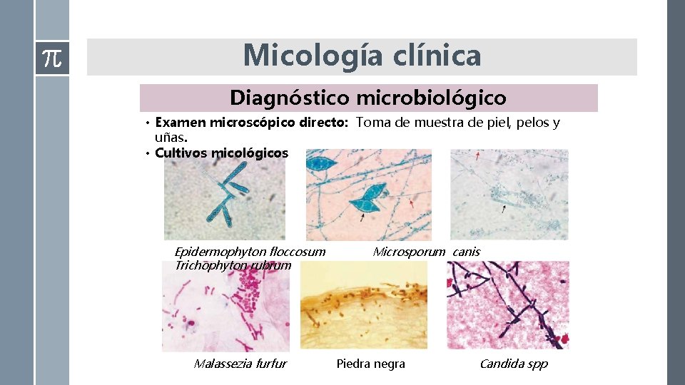 Micología clínica Diagnóstico microbiológico • Examen microscópico directo: Toma de muestra de piel, pelos Micología clínica Diagnóstico microbiológico • Examen microscópico directo: Toma de muestra de piel, pelos