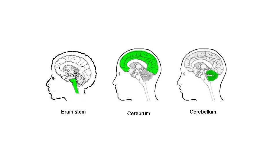 Brain stem Cerebrum Cerebellum 