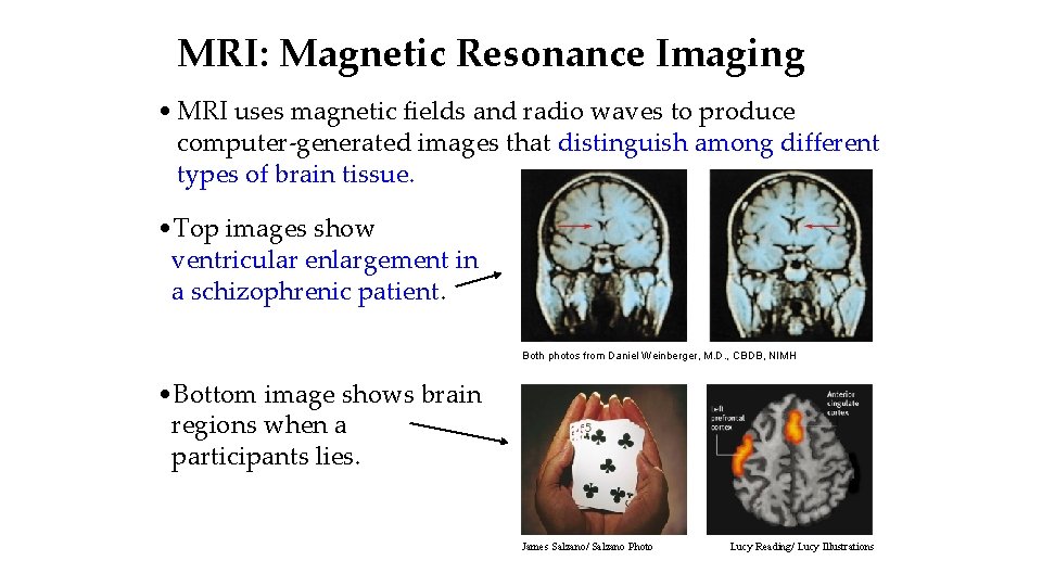 MRI: Magnetic Resonance Imaging • MRI uses magnetic fields and radio waves to produce